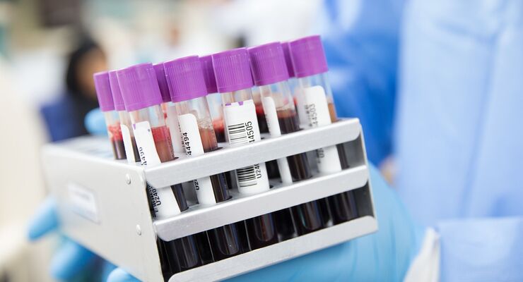 Blutproben im Labor